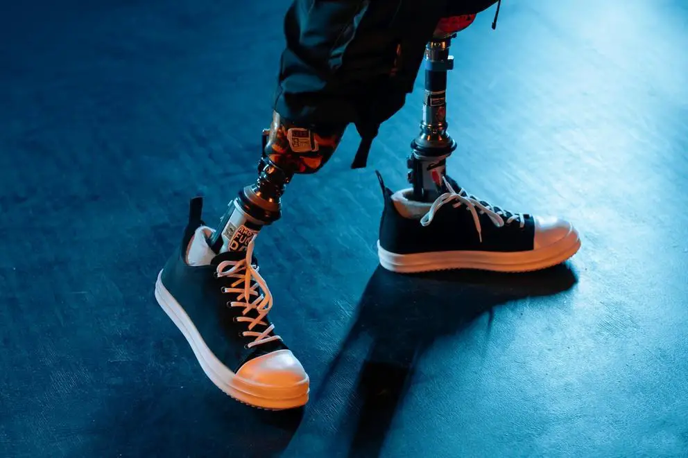 Advancements in Robotic Limb Technology Enhancing Prosthetic Limb